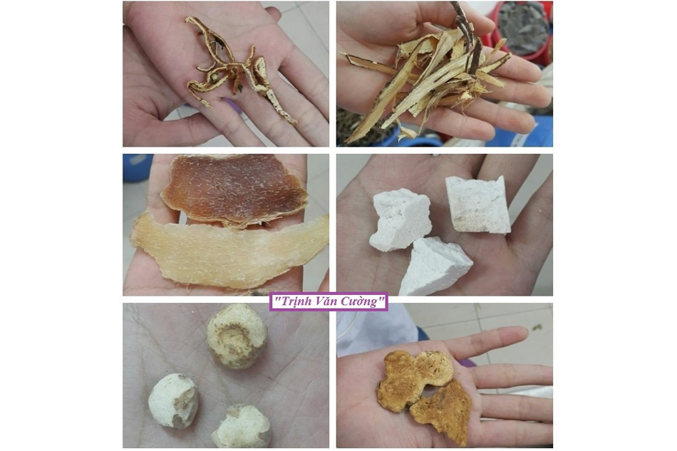 Bài thuốc điều trị thiểu năng tuần hoàn não