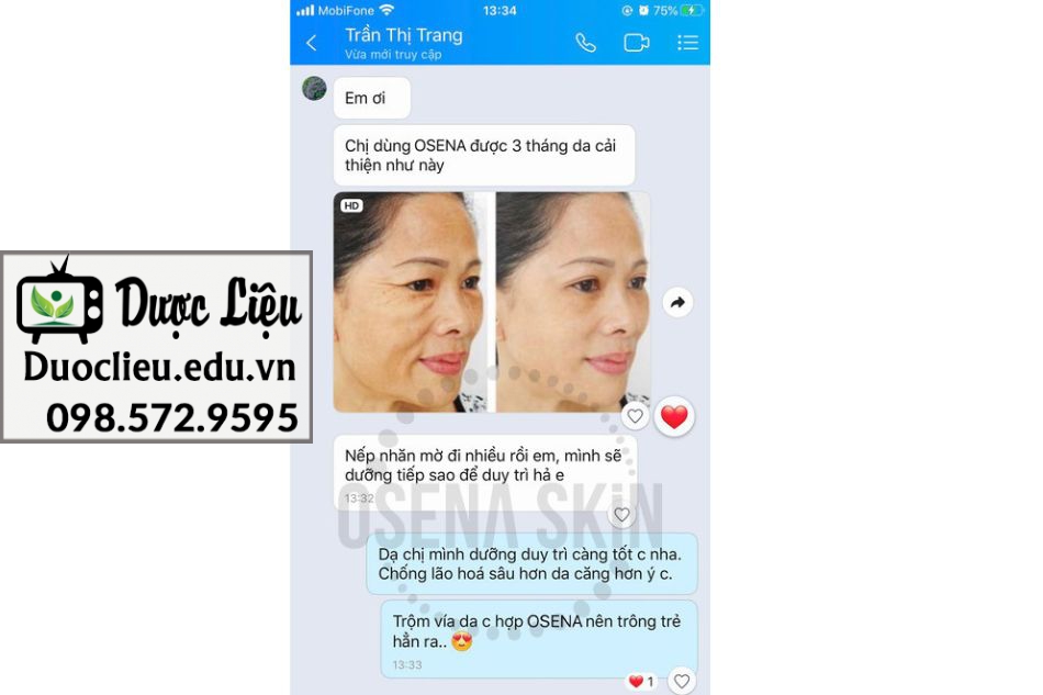 Chị Trang vui mừng vì thành quả đạt đượcsau khi dùng kem Cerepron Osena Skin trị nám.